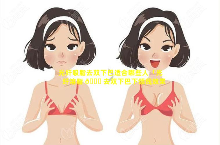 光纤吸脂去双下巴适合哪些人「光纤溶脂 🕊 去双下巴下颌线效果好吗 🌲 」